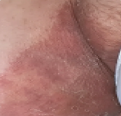 Antes