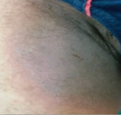 Antes