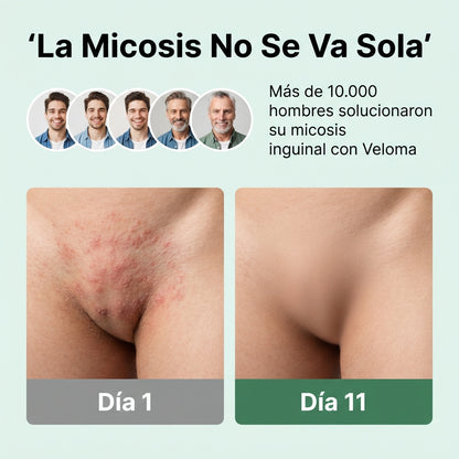 Jabón antimicótico Veloma™